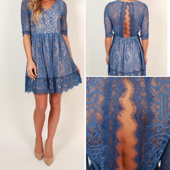 Dresses & Skirts - Final drop! Blue Lace Open Back 👗 | M/L |